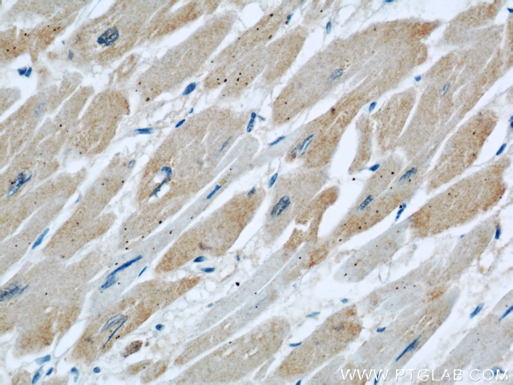 Immunohistochemistry (IHC) staining of human heart tissue using DOCK8 Polyclonal antibody (11622-1-AP)