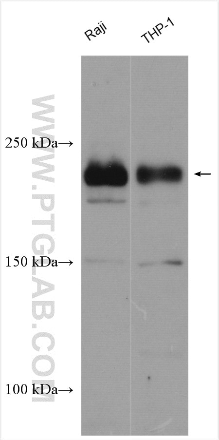 Western Blot (WB) analysis of various lysates using DOCK8 Polyclonal antibody (11622-1-AP)