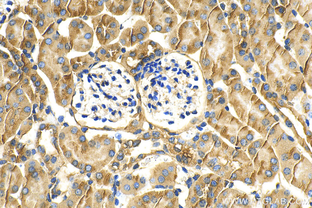 Immunohistochemistry (IHC) staining of mouse kidney tissue using DOCK8 Recombinant antibody (83270-2-RR)