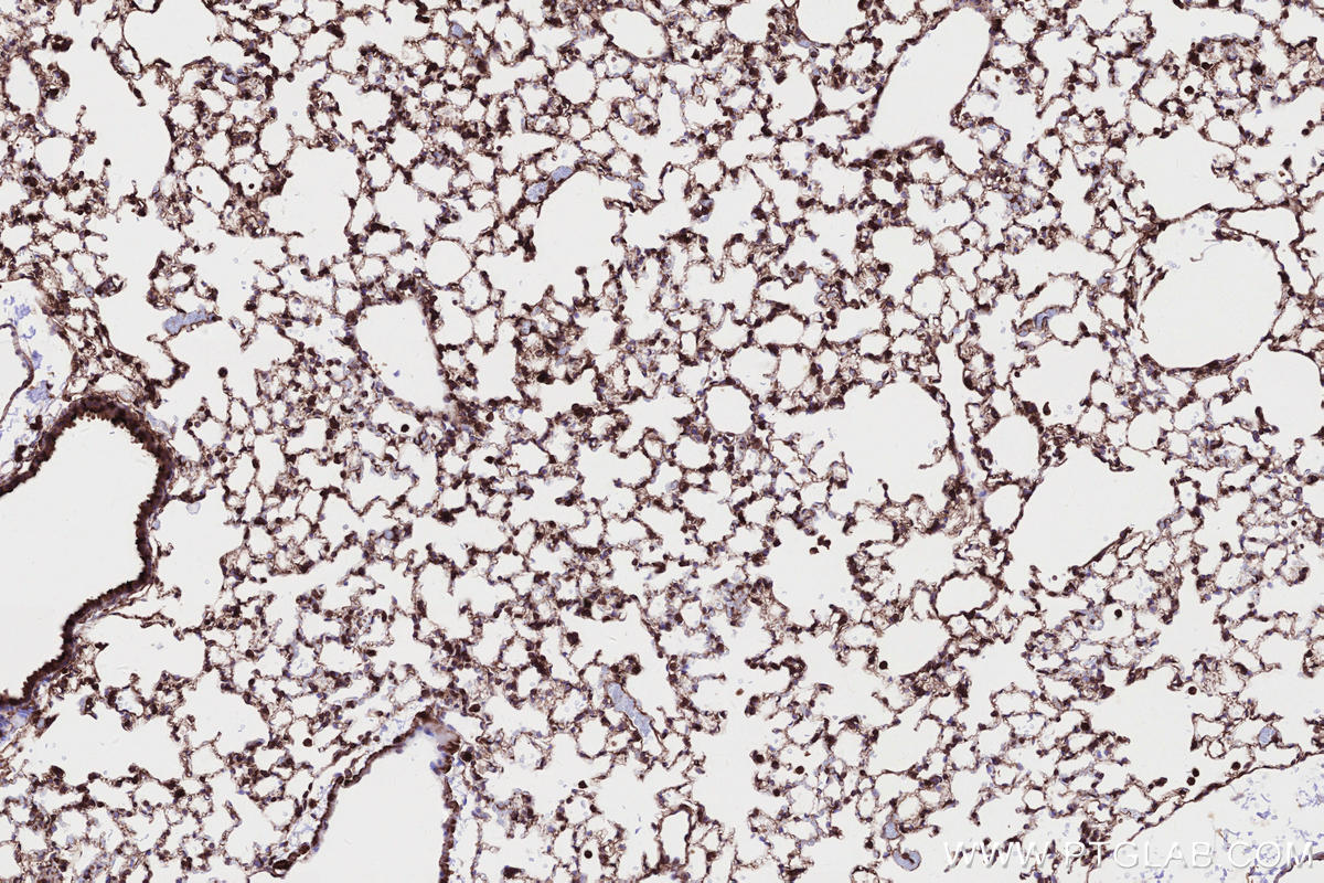 IHC staining of mouse lung using 83270-2-RR Immunohistochemistry (IHC) staining of mouse lung tissue using DOCK8 Recombinant monoclonal antibody (83270-2-RR)