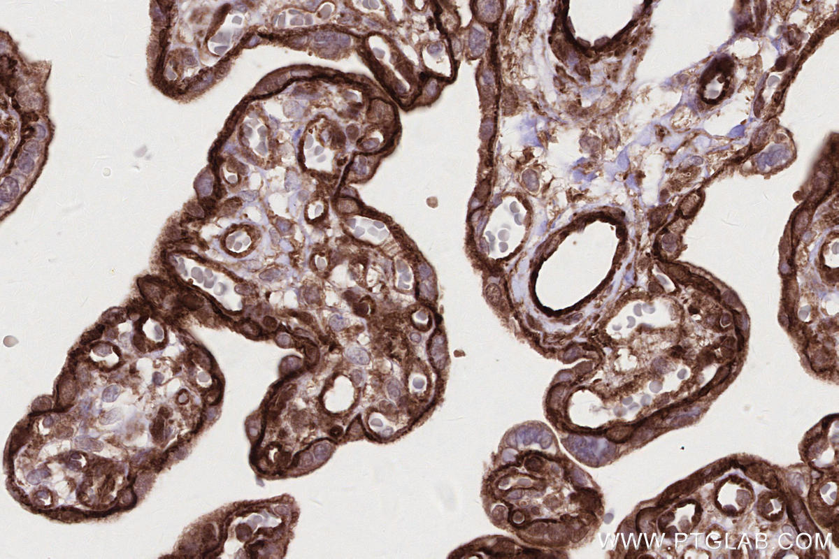 IHC staining of human placenta using 83270-2-RR Immunohistochemistry (IHC) staining of human placenta tissue using DOCK8 Recombinant monoclonal antibody (83270-2-RR)