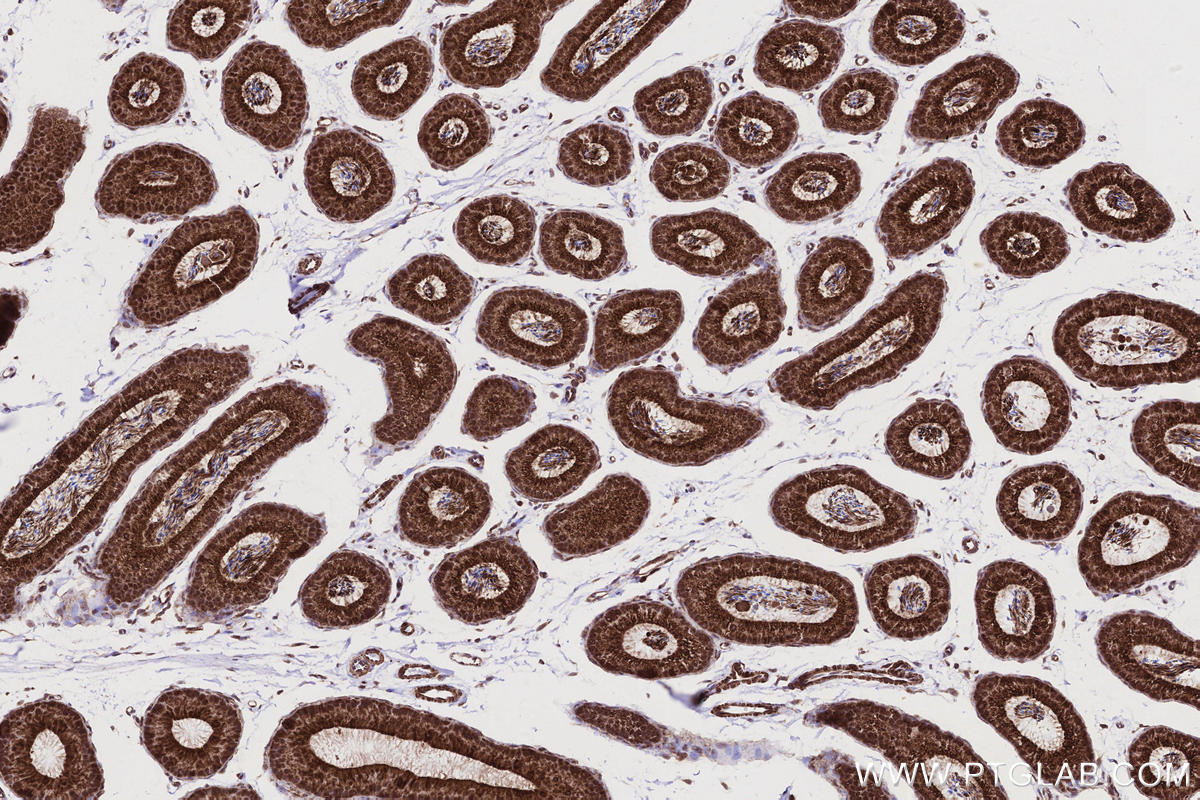 IHC staining of mouse epididymis using 83270-2-RR Immunohistochemistry (IHC) staining of mouse epididymis tissue using DOCK8 Recombinant monoclonal antibody (83270-2-RR)