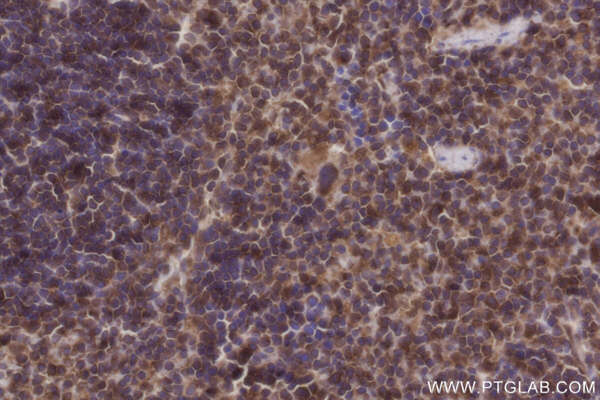 IHC staining of mouse spleen using 83270-2-RR Immunohistochemistry (IHC) staining of mouse spleen tissue using DOCK8 Recombinant monoclonal antibody (83270-2-RR)