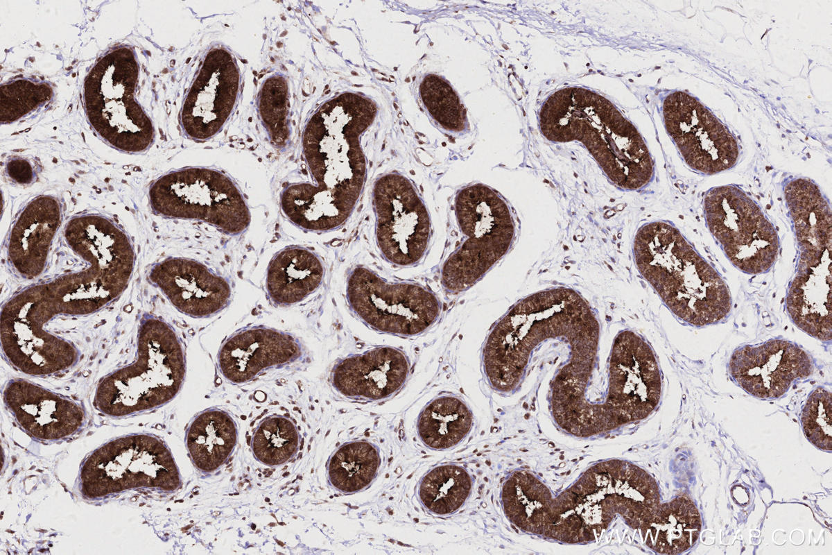 IHC staining of rat epididymis using 83270-2-RR Immunohistochemistry (IHC) staining of rat epididymis tissue using DOCK8 Recombinant monoclonal antibody (83270-2-RR)