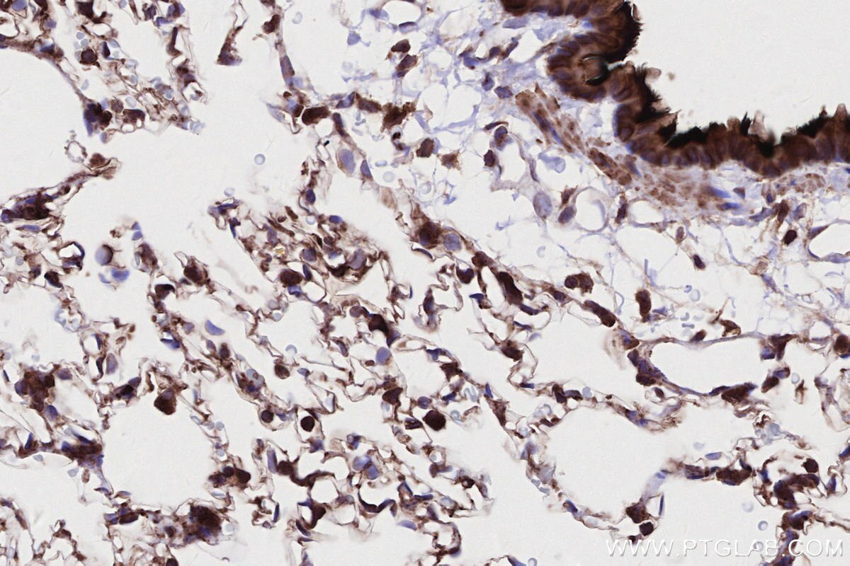 IHC staining of rat lung using 83270-2-RR Immunohistochemistry (IHC) staining of rat lung tissue using DOCK8 Recombinant monoclonal antibody (83270-2-RR)