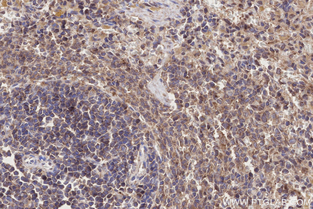 IHC staining of rat spleen using 83270-2-RR Immunohistochemistry (IHC) staining of rat spleen tissue using DOCK8 Recombinant monoclonal antibody (83270-2-RR)