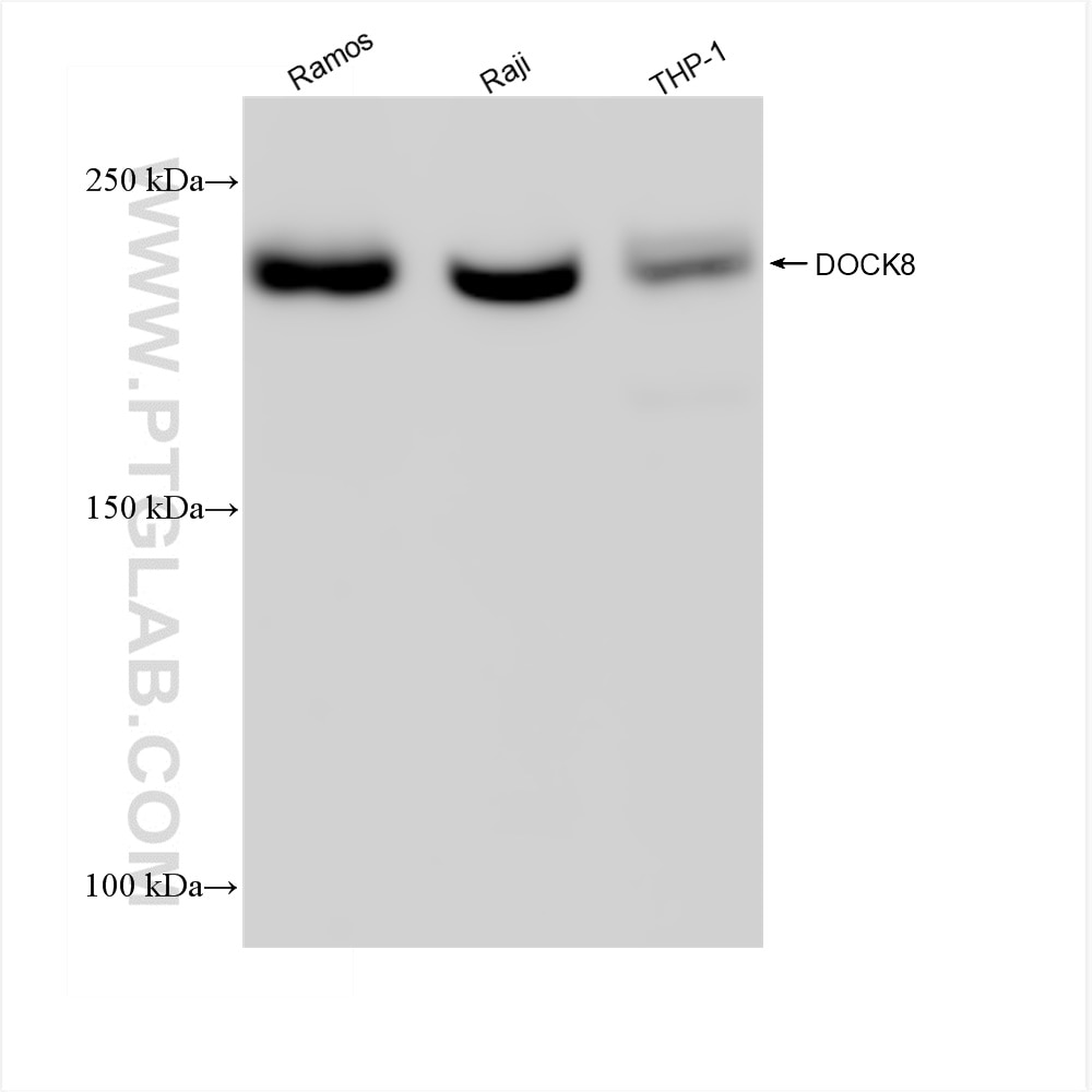 Western Blot (WB) analysis of various lysates using DOCK8 Recombinant antibody (83270-2-RR)