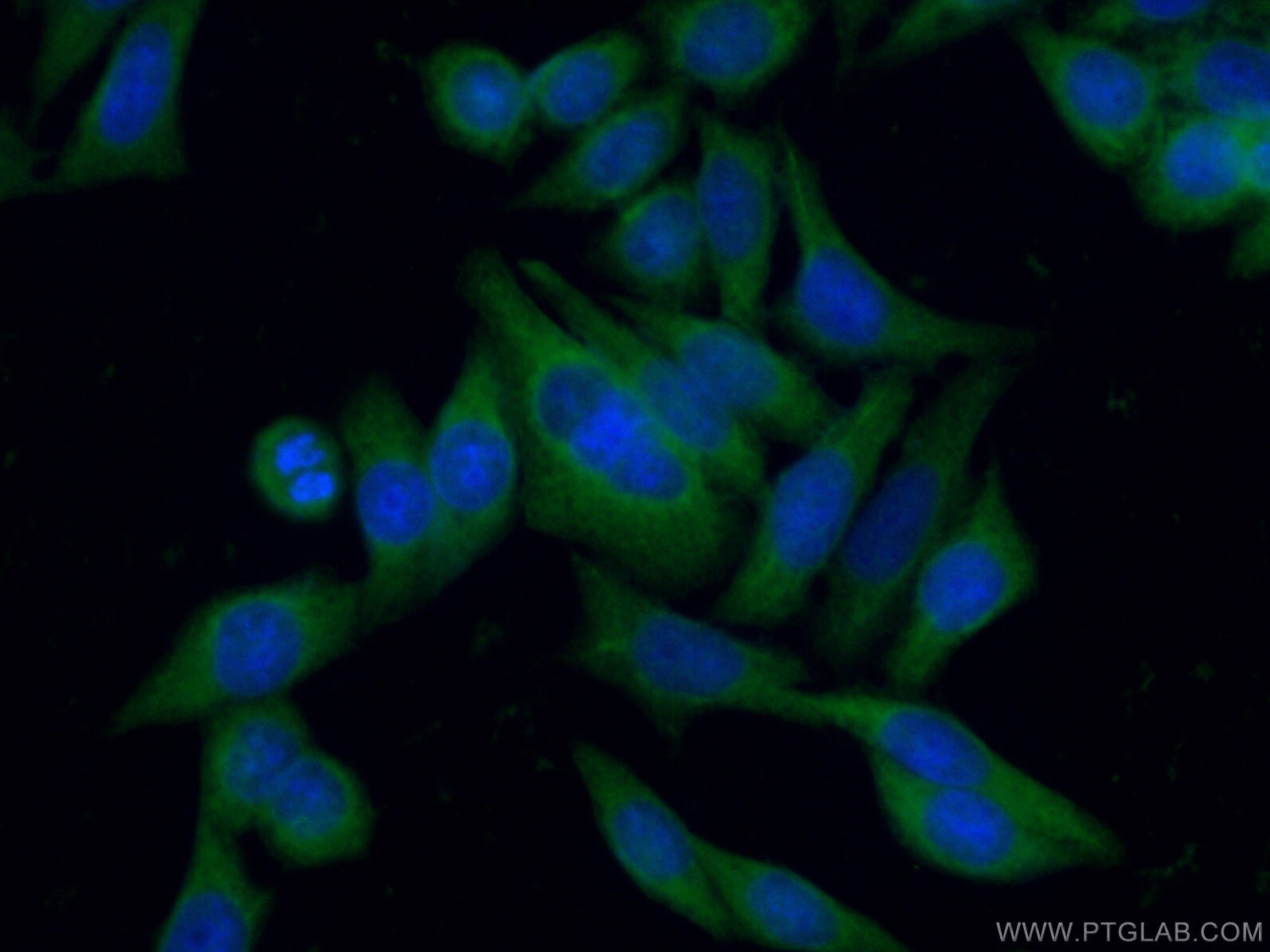 Immunofluorescence (IF) / fluorescent staining of HeLa cells using DOCK9 Polyclonal antibody (18987-1-AP)