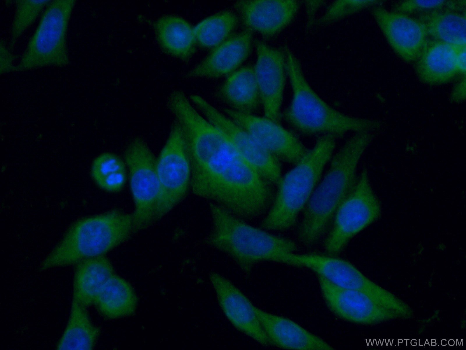 IF Staining of HeLa using 18987-1-AP