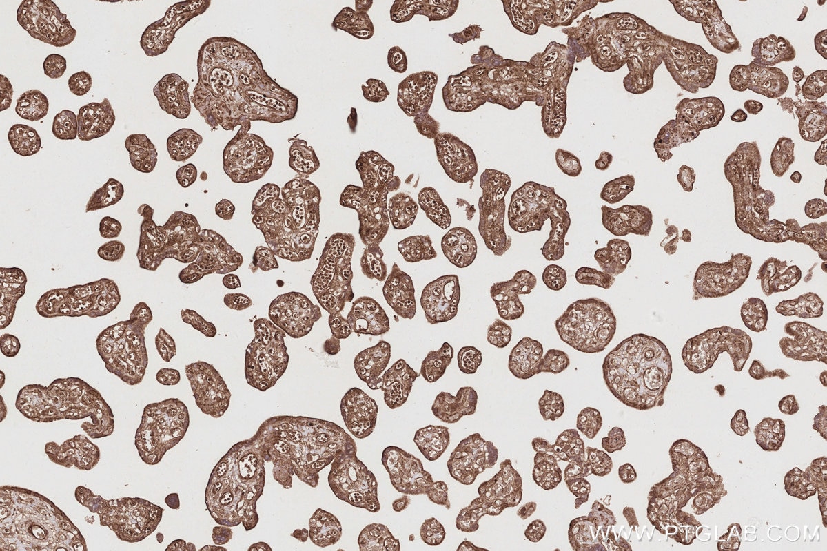 Immunohistochemistry (IHC) staining of human placenta tissue using DOCK9 Polyclonal antibody (18987-1-AP)