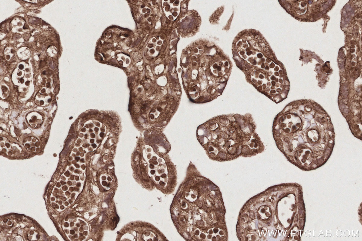 IHC staining of human placenta using 18987-1-AP Immunohistochemistry (IHC) staining of human placenta tissue using DOCK9 Polyclonal antibody (18987-1-AP)