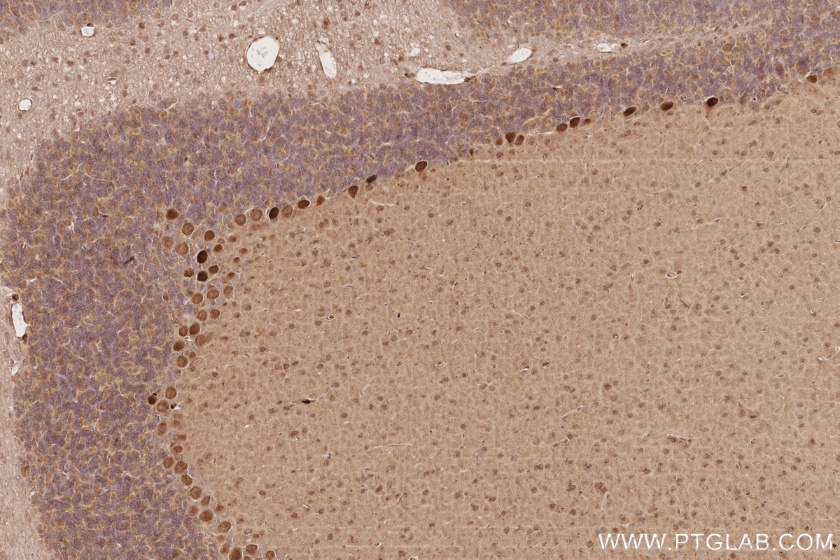 Immunohistochemistry (IHC) staining of rat cerebellum tissue using DOCK9 Polyclonal antibody (18987-1-AP)