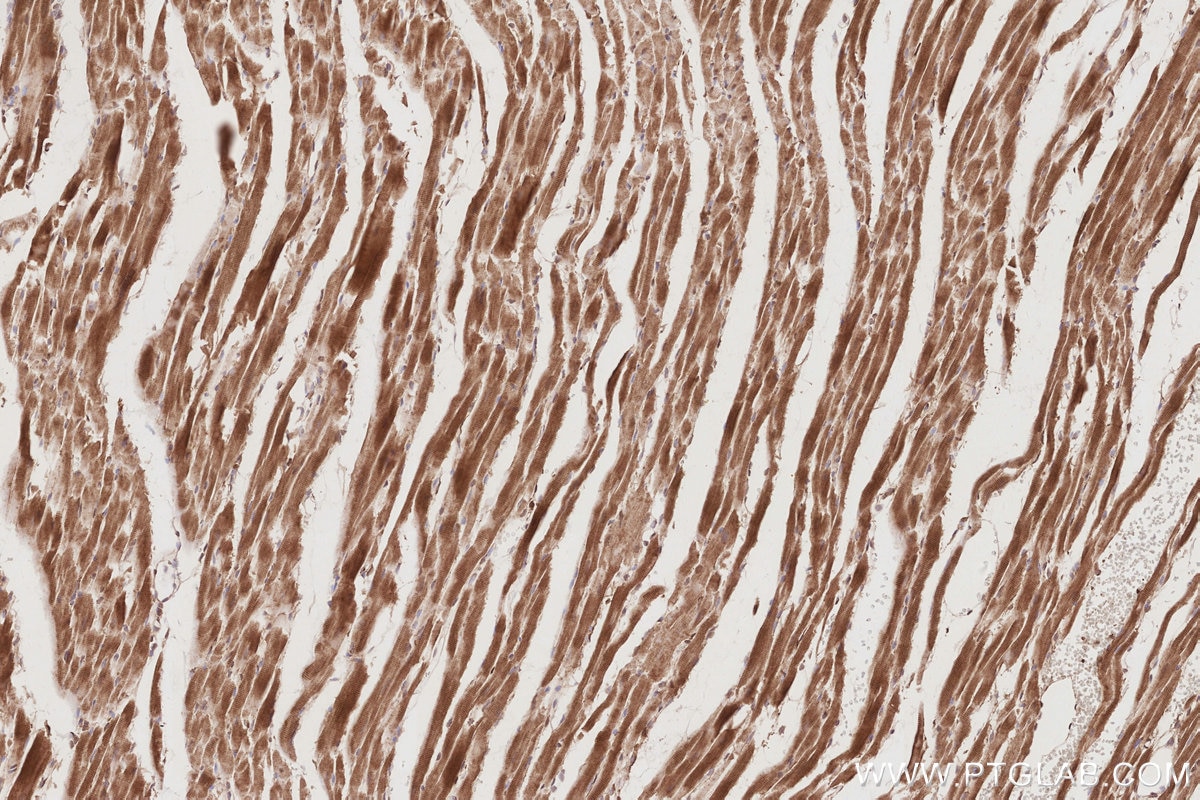 Immunohistochemistry (IHC) staining of rat heart tissue using DOCK9 Polyclonal antibody (18987-1-AP)