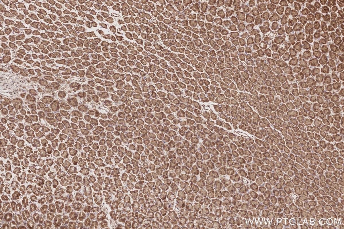 Immunohistochemistry (IHC) staining of rat stomach tissue using DOCK9 Polyclonal antibody (18987-1-AP)