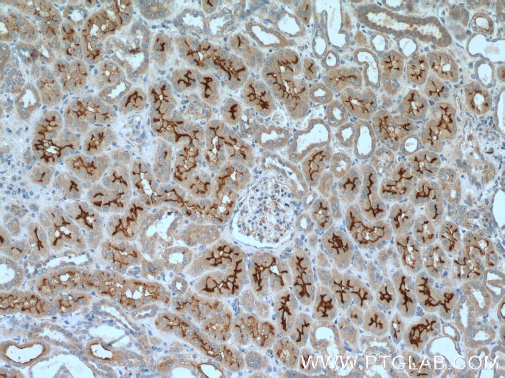 Immunohistochemistry (IHC) staining of human kidney tissue using DOCK9 Polyclonal antibody (18987-1-AP)