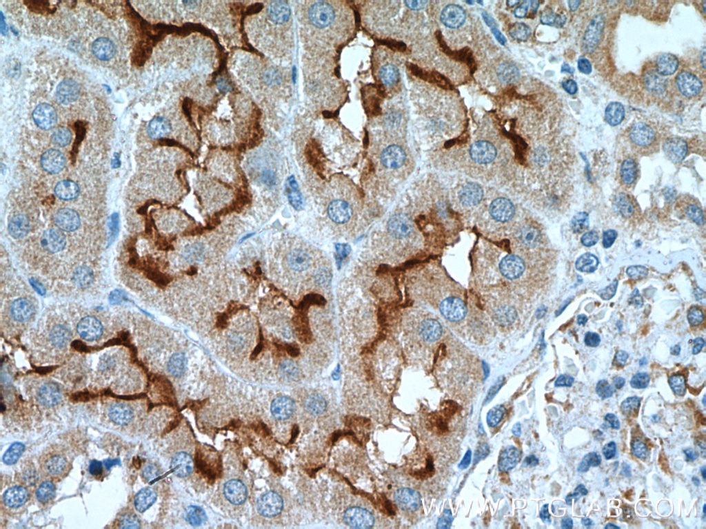 Immunohistochemistry (IHC) staining of human kidney tissue using DOCK9 Polyclonal antibody (18987-1-AP)
