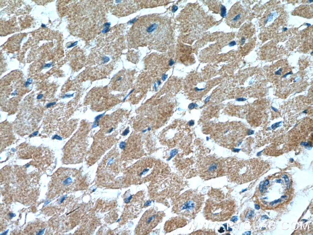 Immunohistochemistry (IHC) staining of human heart tissue using DOCK9 Polyclonal antibody (18987-1-AP)
