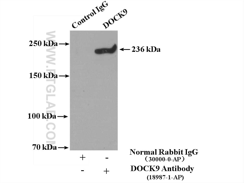 Immunoprecipitation (IP) experiment of mouse brain tissue using DOCK9 Polyclonal antibody (18987-1-AP)