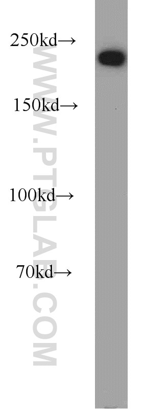 Western Blot (WB) analysis of mouse brain tissue using DOCK9 Polyclonal antibody (18987-1-AP)