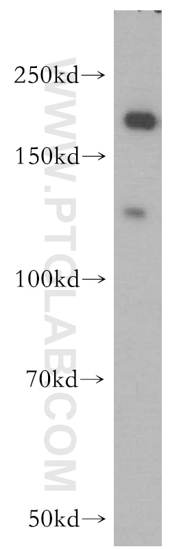 Western Blot (WB) analysis of human brain tissue using DOCK9 Polyclonal antibody (18987-1-AP)
