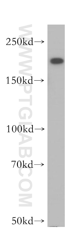 Western Blot (WB) analysis of A549 cells using DOCK9 Polyclonal antibody (18987-1-AP)