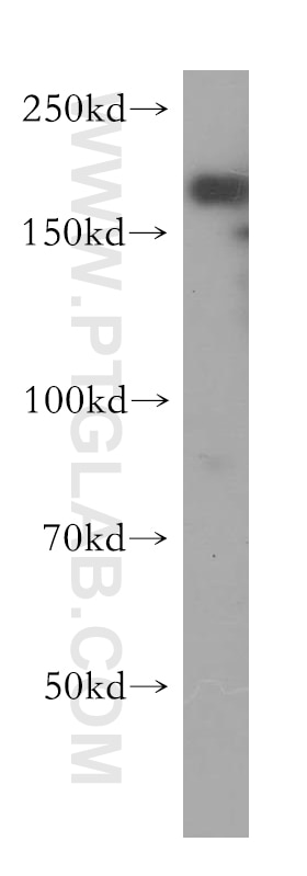 Western Blot (WB) analysis of human heart tissue using DOCK9 Polyclonal antibody (18987-1-AP)