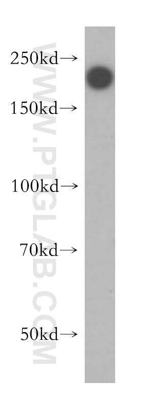 Western Blot (WB) analysis of human placenta tissue using DOCK9 Polyclonal antibody (18987-1-AP)