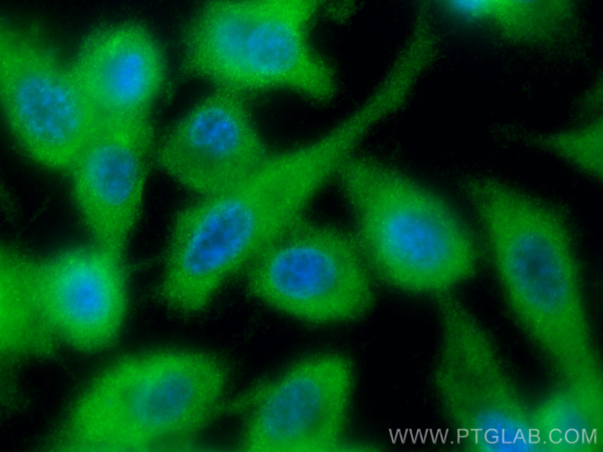 IF Staining of PC-3 using 18226-1-AP Immunofluorescence (IF) / fluorescent staining of PC-3 cells using DOHH Polyclonal antibody (18226-1-AP)