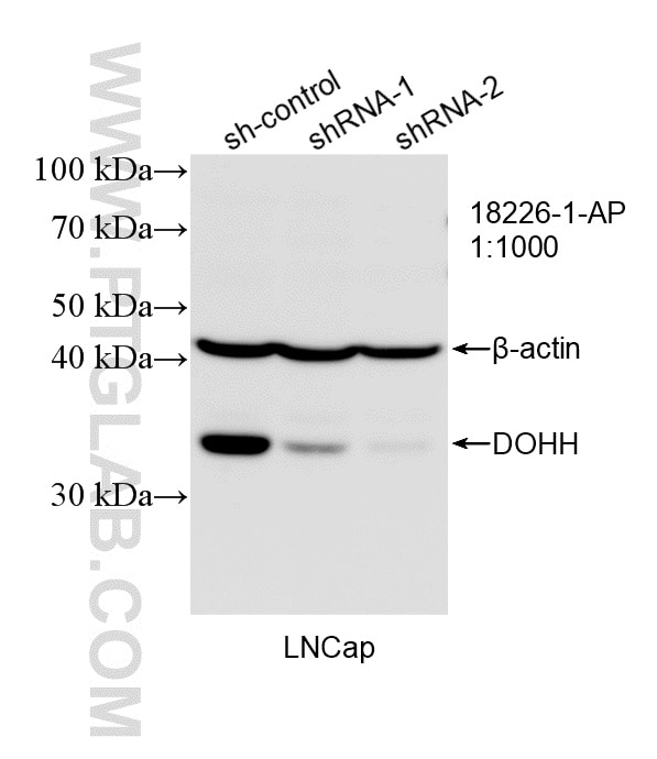Western Blot (WB) analysis of LNCaP cells using DOHH Polyclonal antibody (18226-1-AP)
