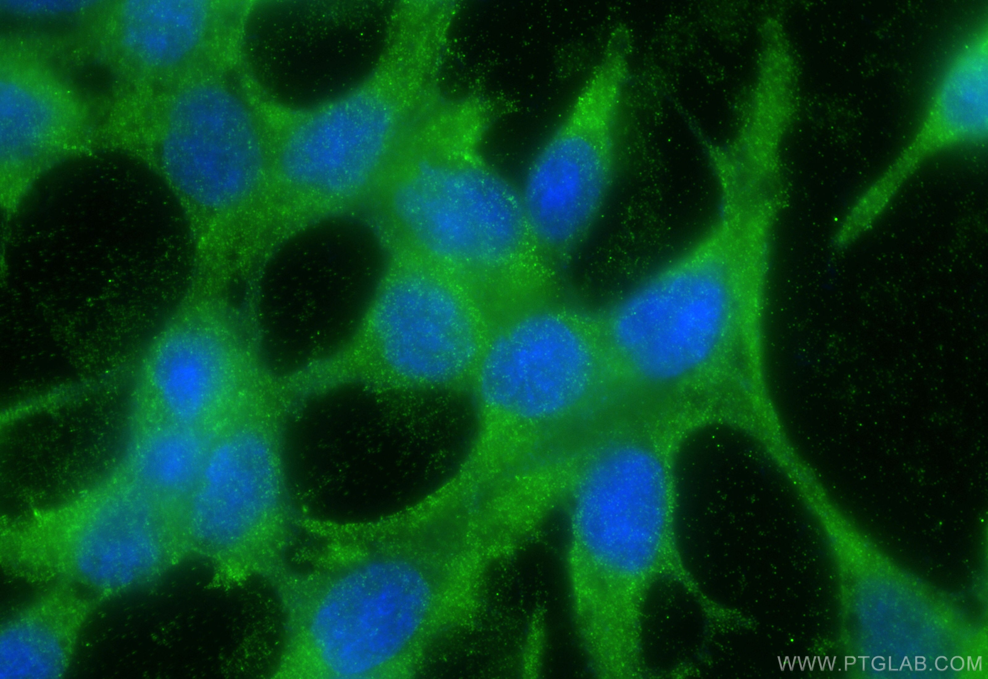 Immunofluorescence (IF) / fluorescent staining of LNCaP cells using DOHH Monoclonal antibody (68151-1-Ig)