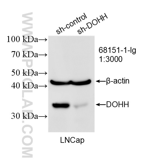 WB result of DOHH antibody (68151-1-Ig; 1:3000; incubated at room temperature for 1.5 hours) with sh-Control and sh-DOHH transfected LNCaP cells. Western Blot (WB) analysis of LNCaP cells using DOHH Monoclonal antibody (68151-1-Ig)
