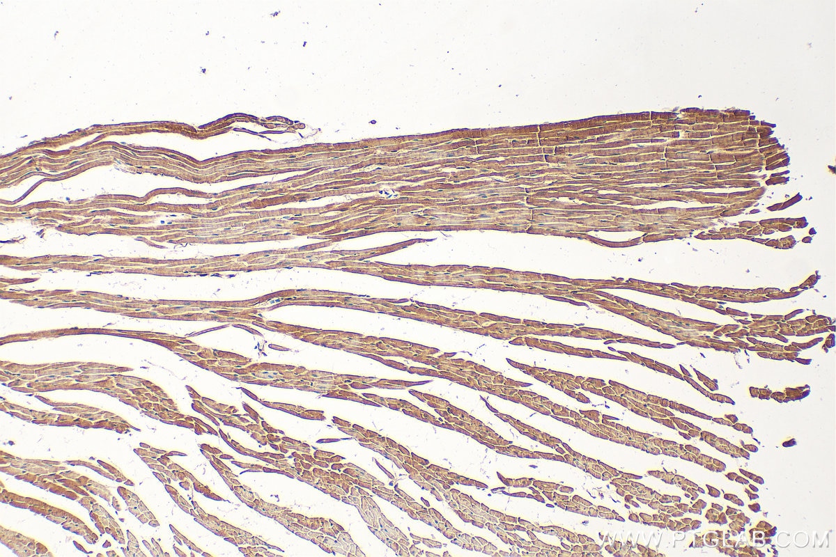 Immunohistochemistry (IHC) staining of mouse heart tissue using DOK1 Polyclonal antibody (17822-1-AP)