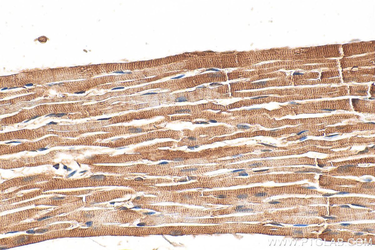 Immunohistochemistry (IHC) staining of mouse heart tissue using DOK1 Polyclonal antibody (17822-1-AP)