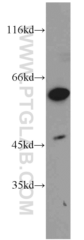 Western Blot (WB) analysis of K-562 cells using DOK1 Polyclonal antibody (17822-1-AP)