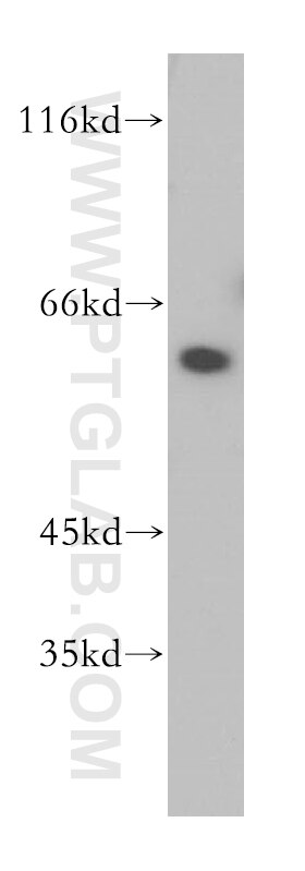 Western Blot (WB) analysis of K-562 cells using DOK1 Polyclonal antibody (17822-1-AP)