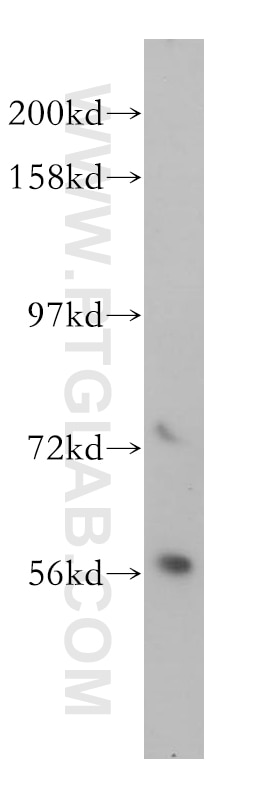 Western Blot (WB) analysis of Jurkat cells using DOK2 Polyclonal antibody (14087-1-AP)