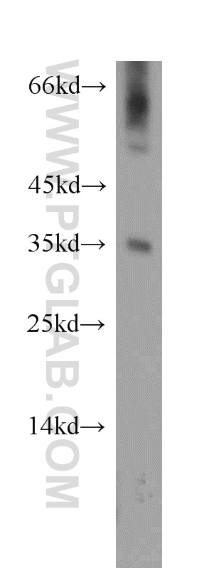 Western Blot (WB) analysis of mouse liver tissue using DOK5 Polyclonal antibody (11948-1-AP)