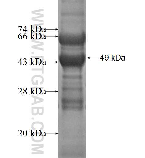DOK5 fusion protein Ag2615 SDS-PAGE