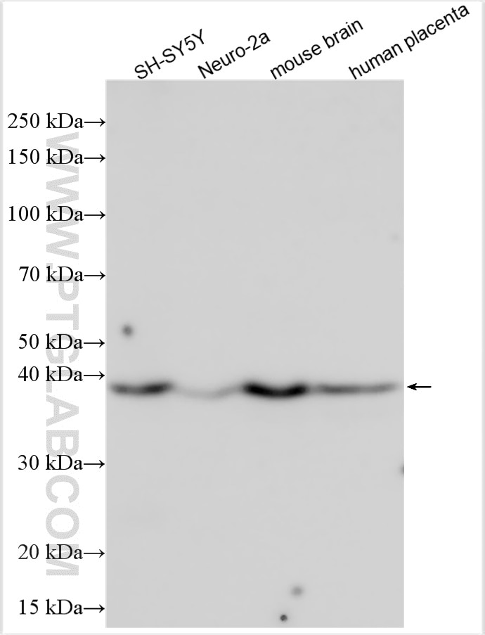 Western Blot (WB) analysis of various lysates using DOK6 Polyclonal antibody (14108-1-AP)