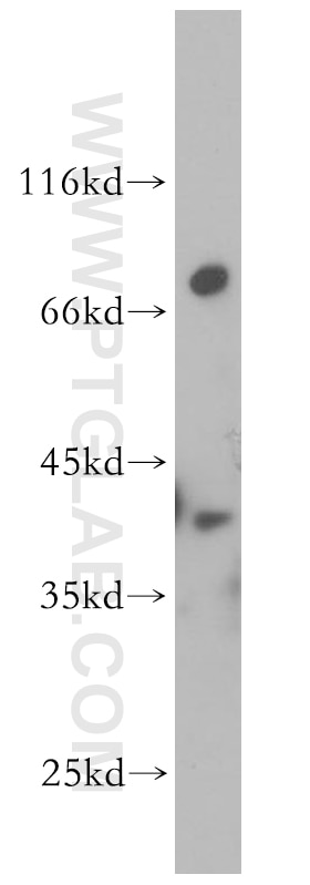 Western Blot (WB) analysis of mouse brain tissue using DOK6 Polyclonal antibody (14108-1-AP)