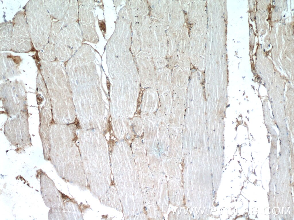 Immunohistochemistry (IHC) staining of human skeletal muscle tissue using DOK7 Polyclonal antibody (22697-1-AP)