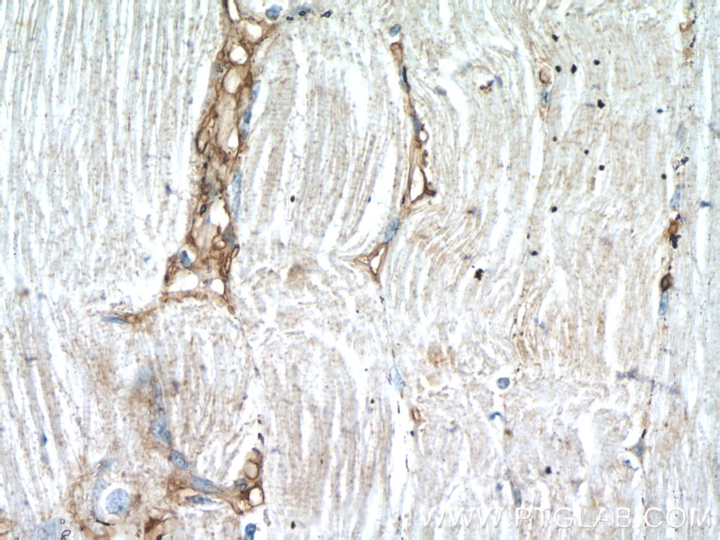 Immunohistochemistry (IHC) staining of human skeletal muscle tissue using DOK7 Polyclonal antibody (22697-1-AP)