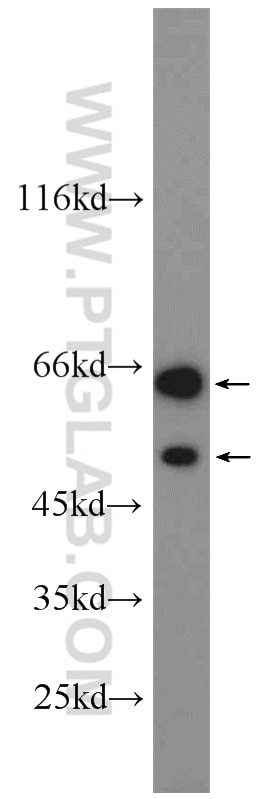 Western Blot (WB) analysis of HEK-293 cells using DOK7 Polyclonal antibody (22697-1-AP)