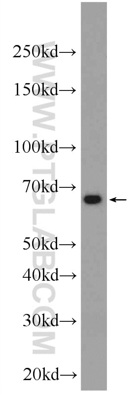 Western Blot (WB) analysis of MCF-7 cells using DOK7 Polyclonal antibody (22697-1-AP)