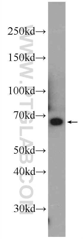 Western Blot (WB) analysis of Jurkat cells using DOK7 Polyclonal antibody (22697-1-AP)