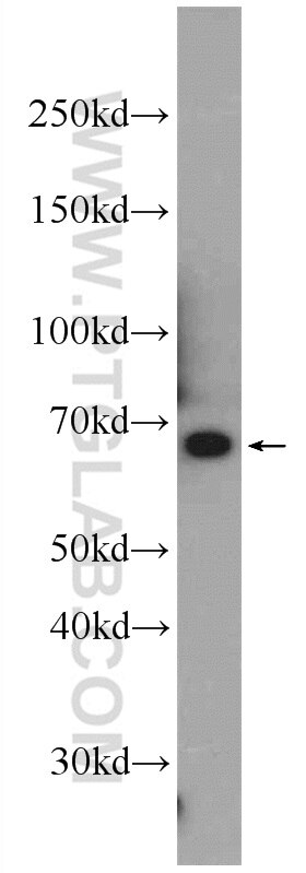 WB analysis of Jurkat using 22697-1-AP