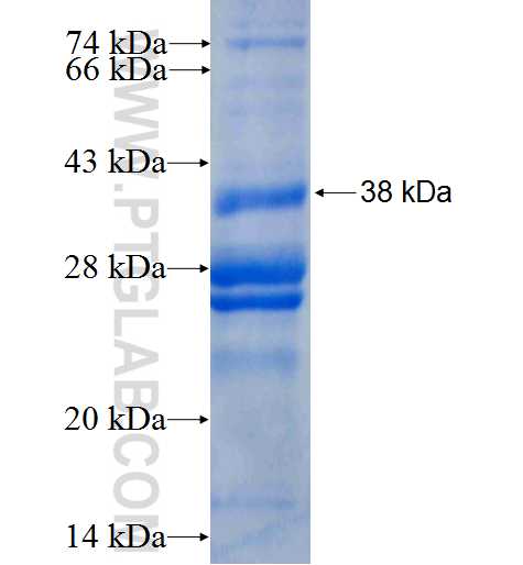 DOLK fusion protein Ag24754 SDS-PAGE