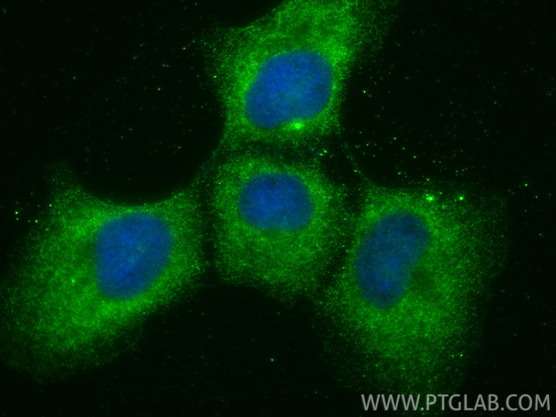 IF Staining of A431 using 34200-1-AP (same clone as 34200-1-PBS) Immunofluorescence (IF) / fluorescent staining of A431 cells using DOLPP1 Polyclonal antibody (34200-1-AP)