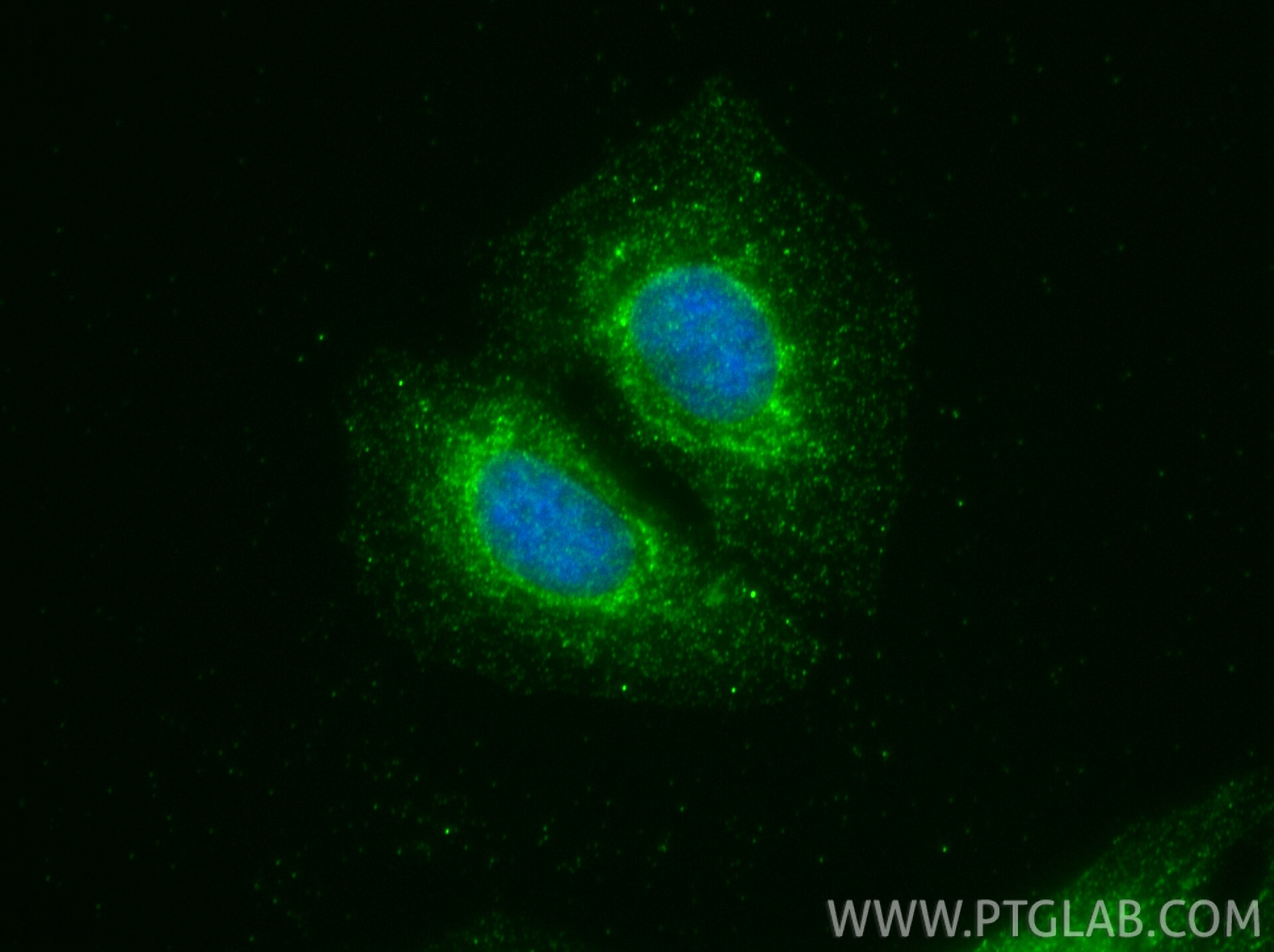 IF Staining of U2OS using 34200-1-AP (same clone as 34200-1-PBS) Immunofluorescence (IF) / fluorescent staining of U2OS cells using DOLPP1 Polyclonal antibody (34200-1-AP)