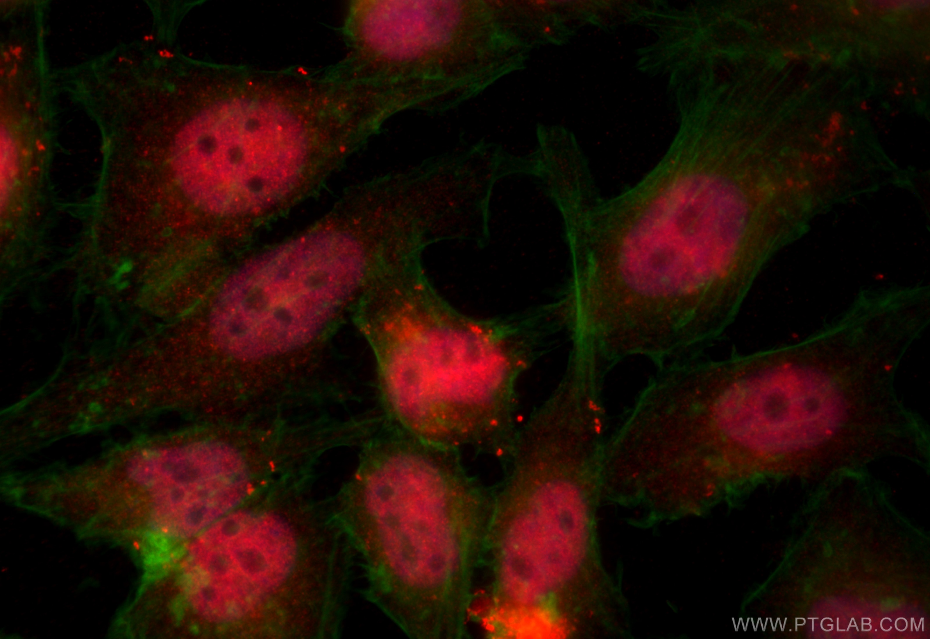 Immunofluorescence (IF) / fluorescent staining of HeLa cells using DOM3Z Polyclonal antibody (11015-2-AP)